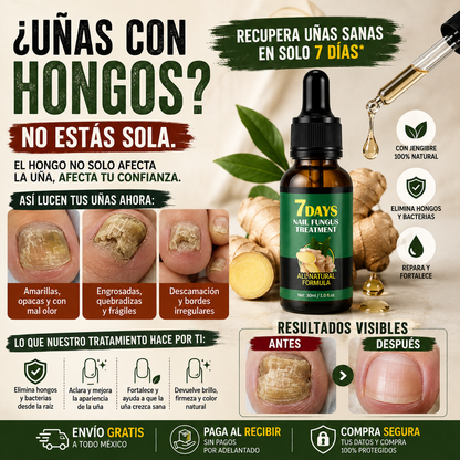 GingerNails™ - Sérum Fortalecedor de Uñas