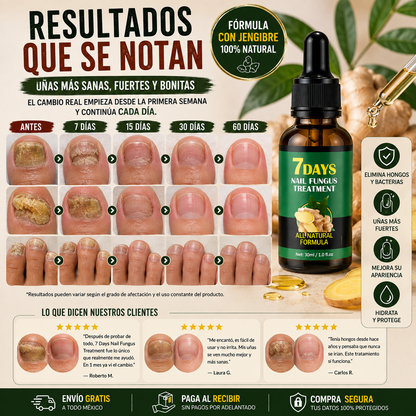 GingerNails™ - Sérum Fortalecedor de Uñas